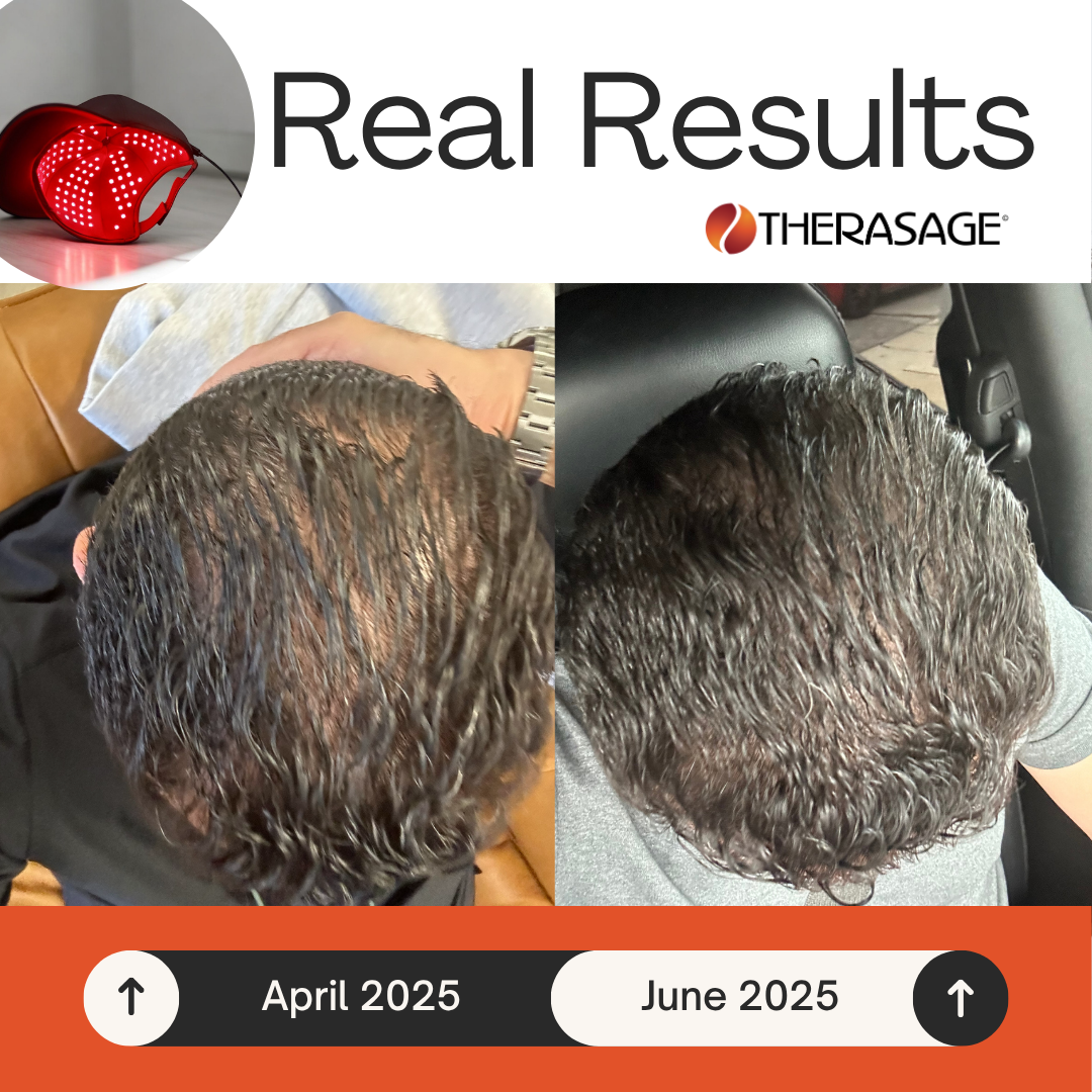 TheraCap Red Light Therapy Hair & Scalp Device